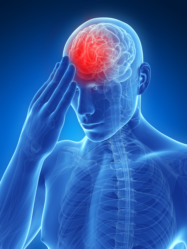 photo illustration of person with head pain